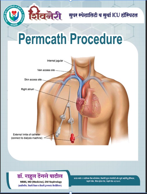 Permcath procedure — dialysis catheter, Shivneri Super Speciality & Surya ICU Hospital